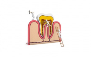 牙体缺损有哪些方法可以修好